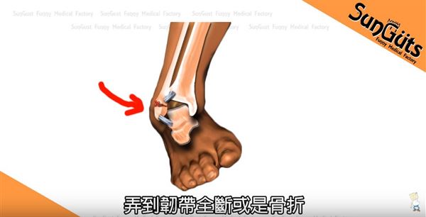 必威体育-季后赛带伤作战！杰威接受右手韧带撕裂修复手术(韧带撕裂严重还是骨折严重)